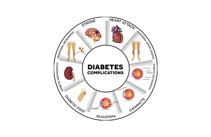 diabetes nutritional management